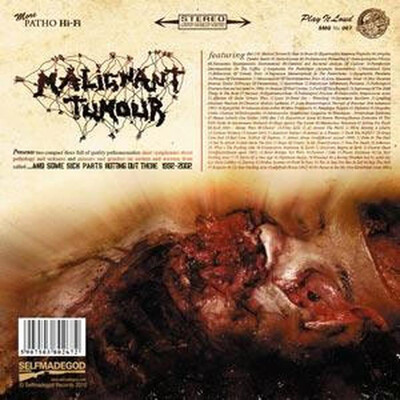 MALIGNANT TUMOUR - ...AND SOME SICK PARTS ROTTING OUT THERE 1992-2002 (2XCD)